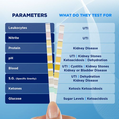 100 x Urine Infection Test Strips, UTI, Cystitis, Leukocytes, Urinary, Bladder — image 4