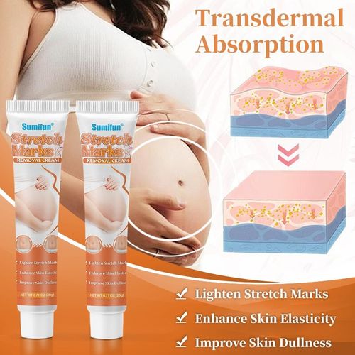 Pregnancy StretchMarks Repair Cream Back Abdomen Caesarean Section Scars Removal