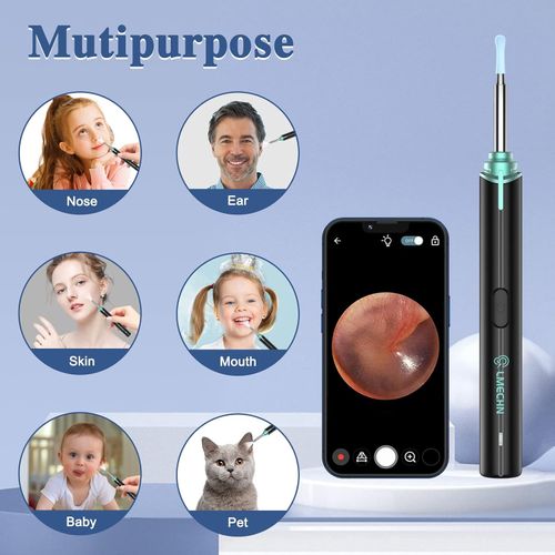 Ear Wax Removal Kit Ear Camera1080P High-Definition Earwax Cleaner ,App Control — image 8