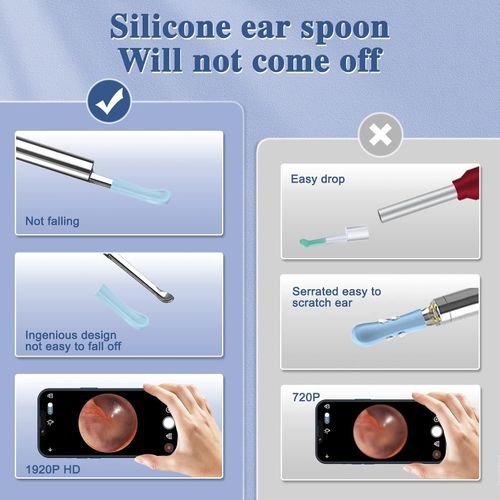 Ear Wax Removal Kit Ear Camera1080P High-Definition Earwax Cleaner ,App Control — image 7
