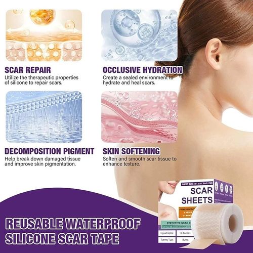 Silicone Scar Sheet MEDICAL GRADE Scar Removal Silicone Tape Treatment