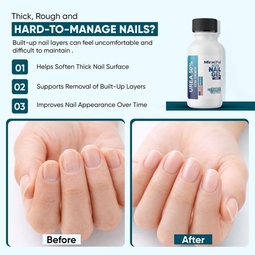 Urea 50% Nail Gel for Thick Toenails & Calluses, Softens & Exfoliates, Quick-Dry — image 4