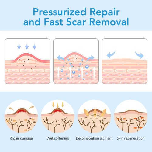 4cm*1.5m Medical Grade Scar Removal Tape Silicone Scar Sheets Treatment Patches
