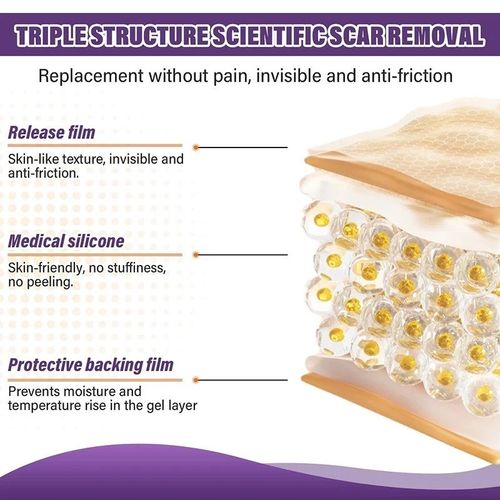 Silicone Scar Sheet MEDICAL GRADE Scar Removal Silicone Tape Treatment