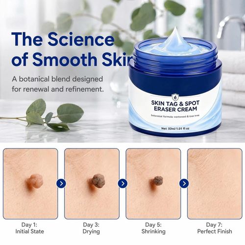 Picdo 7-Day Skin Tag Spot Eraser Cream, Advanced Imperfection Removal Cream — image 4
