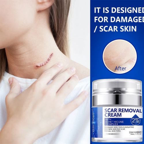 Scar Removal Cream - Rapid Repair of New & Old Scars, Acne Spots, Burns — image 2