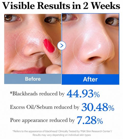 Medicube Zero Pore Pad 2.0 70 Pads 155g AHA BHA Pore Toner Exfoliating Korean — image 4