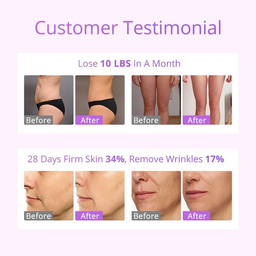S-Shape8 6 in 1 Beauty Machine Full Body Massage Skin Facial Care Salon Use — image 4