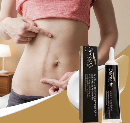 2X Dermatix 15g Silicone Scar Treatment Gel Advanced Silicone Scar UK SELLER — image 2