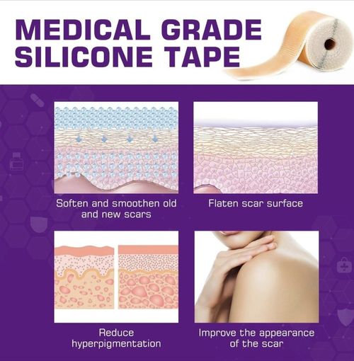 Kelinul Silicone Scar Tape 4-6 Month Supply — image 2