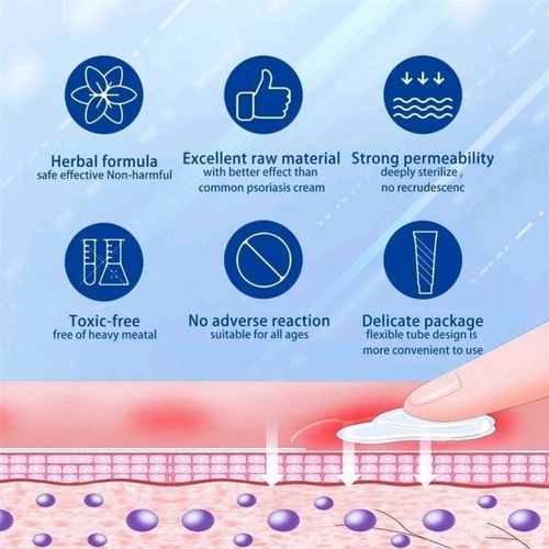 Psoriasis Dermatitis Eczema NATURAL Skin Treatment BALM CREAM OINTMENT 30g 🇬🇧  — image 6