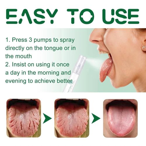Tongue Repair Spray, Dry Mouth Oral Antibacterial, Instant Relief 1 | UK — image 8