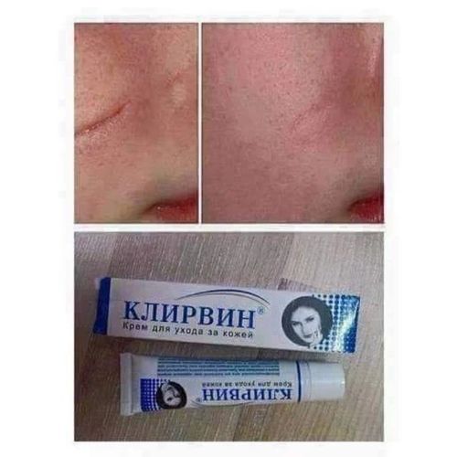 2x KLIRVIN Skin Care Cream 25g for Acne Marks Scars & Stretch Marks — image 4