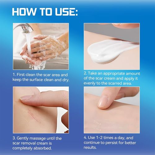 Dermatix Ultra Silicone Scar Gel – Advanced Scar Treatment 15gram UK