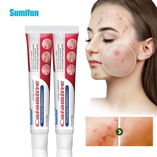 New 20g Rosacea Ointment Treat Red Nose Acne Cream Pimple Scar Repair Skin Care — image 1
