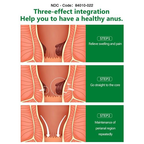 Hemorrhoid Cream Haemorrhoids Fissure Gel Piles Anal Fissure Prolapse Ointment — image 9