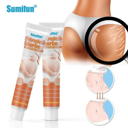 Pregnancy StretchMarks Repair Cream Back Abdomen Caesarean Section Scars Removal
