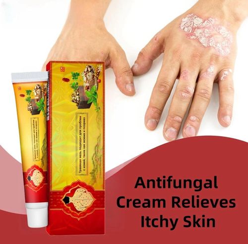 3pcs Antifungal Cream,Cream for Itchy Skin,Antifungal Cream for Skin,Itchy Skin — image 10