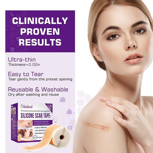 Silicone Scar Tape Plasters removal Kelinul Roll Reusable Sheets Medical grade — image 2