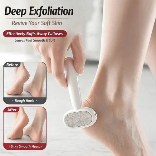 Double Sided Foot Rasp Callus Remover Dead Skin File Pedicure Foot Care Tool — image 4