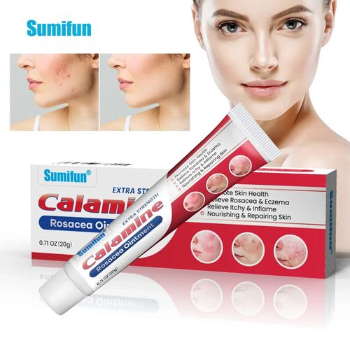New 20g Rosacea Ointment Treat Red Nose Acne Cream Pimple Scar Repair Skin Care — image 13