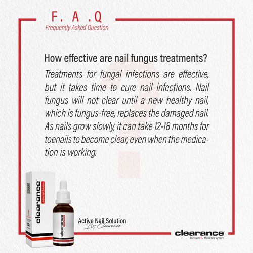 Clearance Active Nail Solution 15ml Free and Fast UK Postage New — image 7