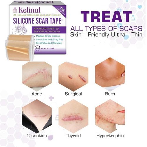 Silicone Scar Tape Plasters removal Kelinul Roll Reusable Sheets Medical grade — image 4
