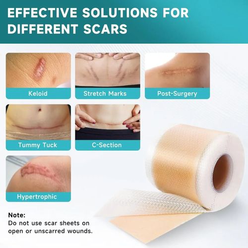 Waterproof Reusable Silicone Scar Tape Breathable Skin Friendly Adhesive Strips — image 7