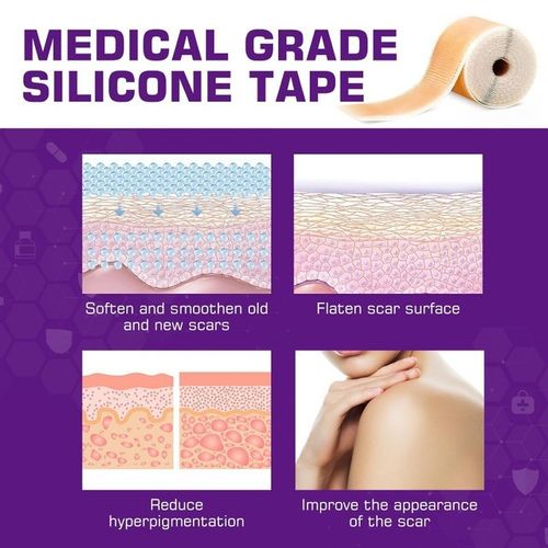 Silicone Scar Tape Plasters removal Kelinul Roll Reusable Sheets Medical grade — image 5