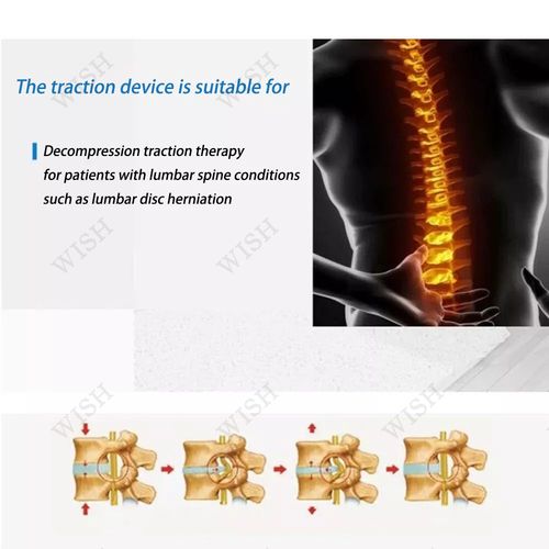 Professional Lumbar Traction Device,Herniated Disc Back Pain Relief Device — image 7