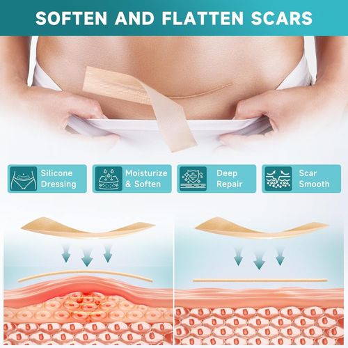 Waterproof Reusable Silicone Scar Tape Breathable Skin Friendly Adhesive Strips — image 5