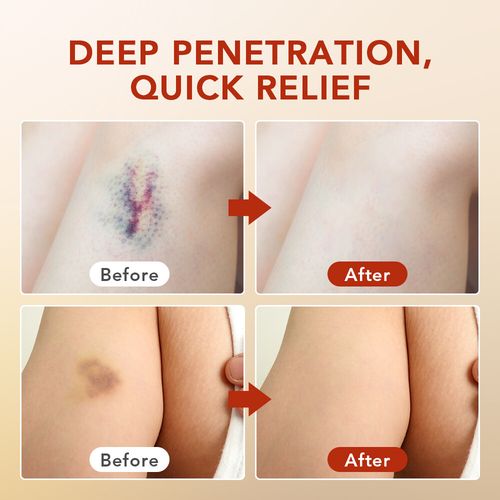 Extra Strong Pain Relief Cream - Joint, Arthritis Muscle and Back Pain Relief — image 15