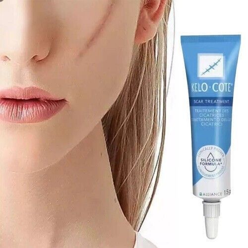 15gSilikongel zur Behandlung von alten und neuen Narben，Scar Treatment UK NEW — image 9