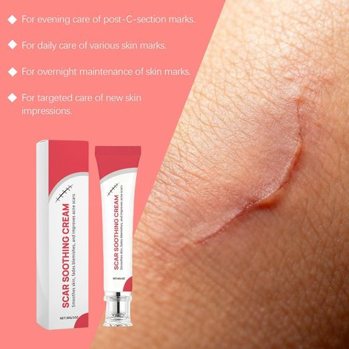 Scar Soothing Cream Scar Gentle Non-Greasy Soothing & Smoothing Skin Cream 30g