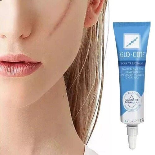15gSilikongel zur Behandlung von alten und neuen Narben，Scar Treatment UK NEW — image 9