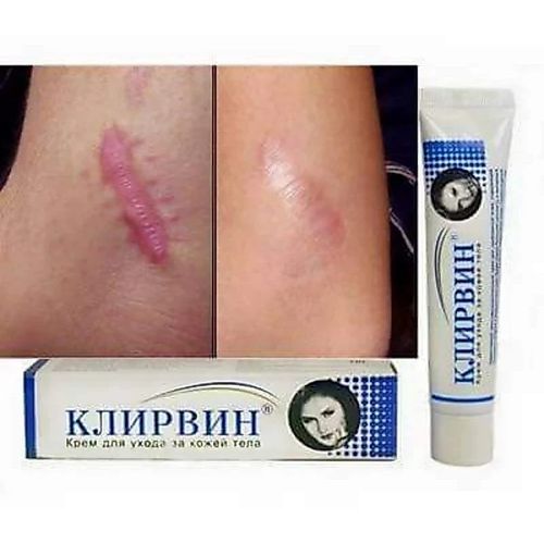 2x KLIRVIN Skin Care Cream 25g for Acne Marks Scars & Stretch Marks — image 3