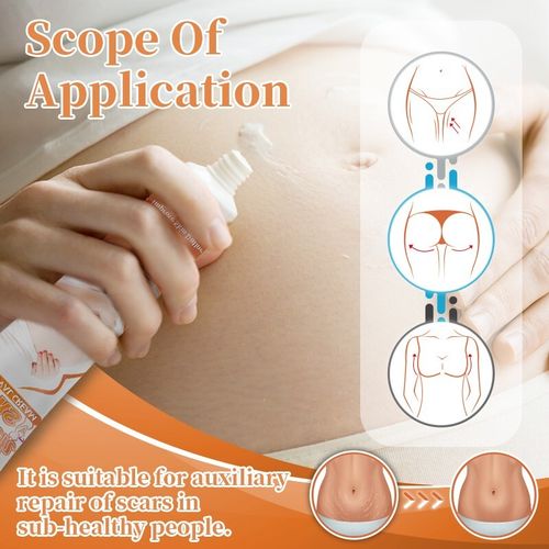 Pregnancy StretchMarks Repair Cream Back Abdomen Caesarean Section Scars Removal