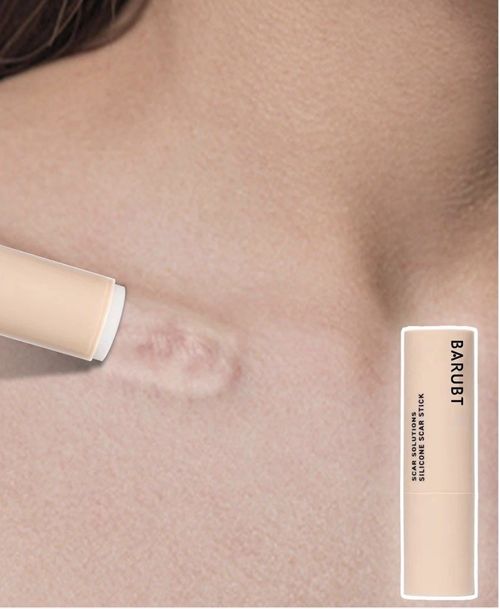 Silicone Scar Stick, Scar Stick Scar Solution with Asiatica Extracts & Vitamin E — image 4