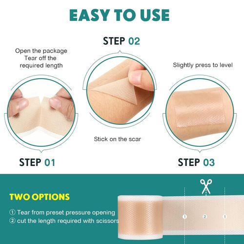 Waterproof Reusable Silicone Scar Tape Breathable Skin Friendly Adhesive Strips — image 4
