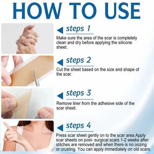 Silicone Scar Sheet MEDICAL GRADE Scar Removal Silicone Tape Treatment