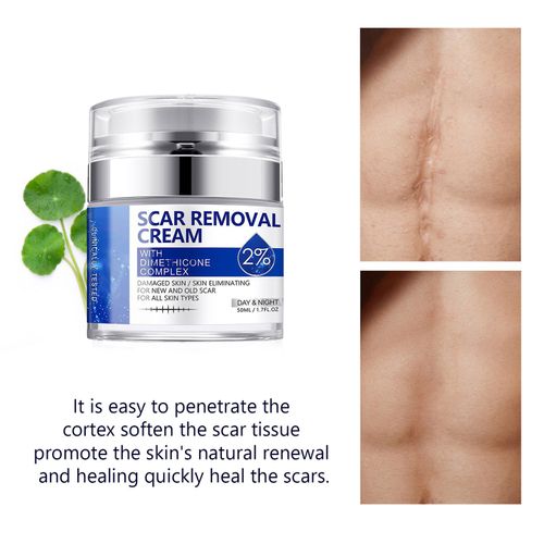 Scar Removal Cream - Rapid Repair of New & Old Scars, Acne Spots, Burns — image 8