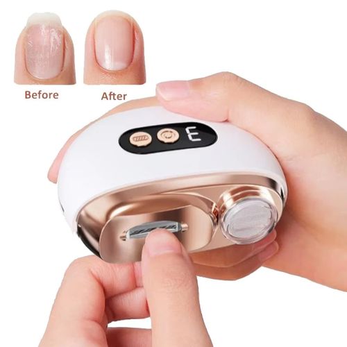 Electric Toe Nail Clippers For Thick Nails Nail Trimmer Cutter USB Rechargeable. — image 2