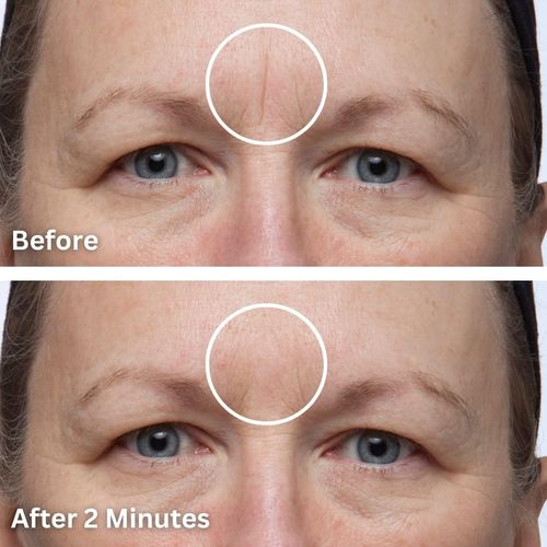 Dermaflage Topical Scar Filler Single Refill Applicator (Light) - Hollywood Sil — image 4