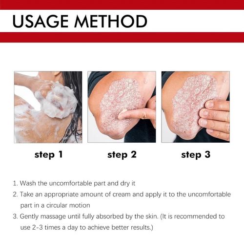 3pcs Antifungal Cream,Cream for Itchy Skin,Antifungal Cream for Skin,Itchy Skin — image 7