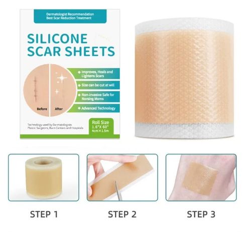 Elaimei Silicone Scar Sheet MEDICAL GRADE Scar Removal Silicone Tape Treatment — image 3
