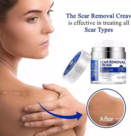 Scar Removal Cream Skin Repair Cream for Old and New Scars Scar Treatment Gel — image 3