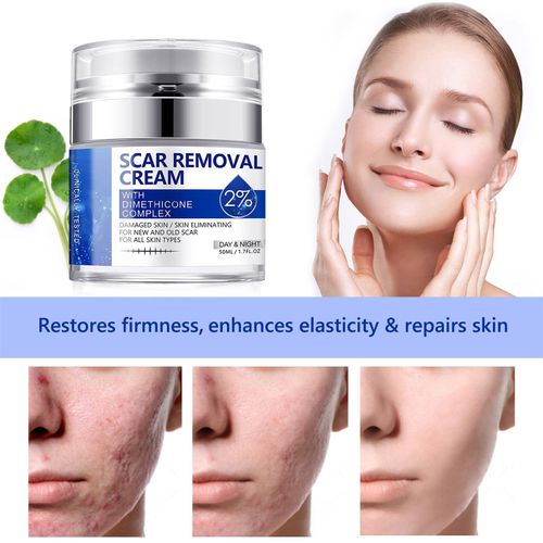 Scar Removal Cream - Rapid Repair of New & Old Scars, Acne Spots, Burns — image 6