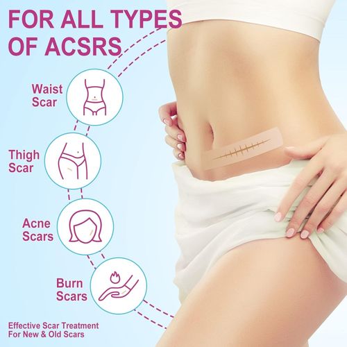 VOGSIG Silicone Scar Sheets Size 1.6"X75" Ultra-Thin Breathable & Waterproof — image 2
