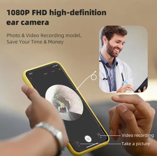 Bebird EarSight Plus Endoscope Otoscope Camera Cleaning Wax Pick Cleaner Kit — image 12