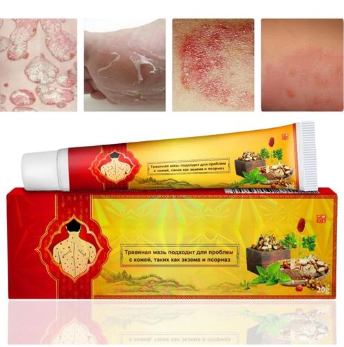 3pcs Antifungal Cream,Cream for Itchy Skin,Antifungal Cream for Skin,Itchy Skin — image 1